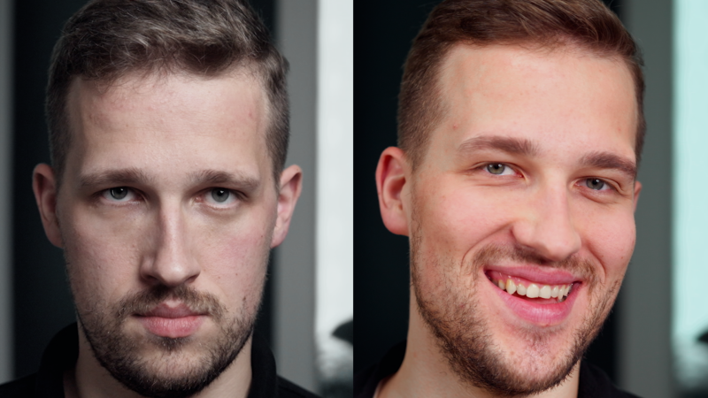 Estetika bez cenzury: Autonehoda, nejistoty, nový začátek. Matěj otevřeně o cestě k sebevědomí