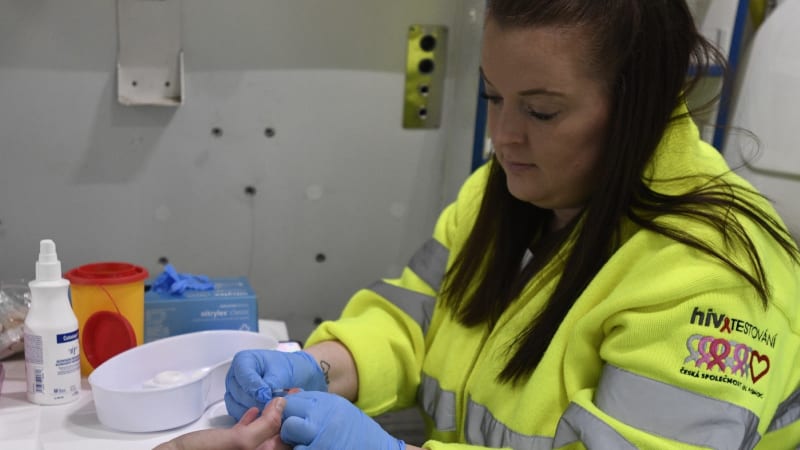 Šíření viru HIV v Česku láme rekordy. Případů bylo loni nejvíce v historii měření